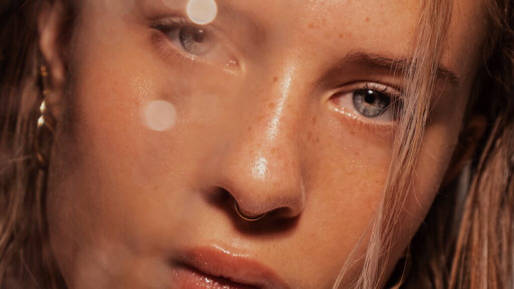 azelaic-acid-for-rosacea-uk-2026