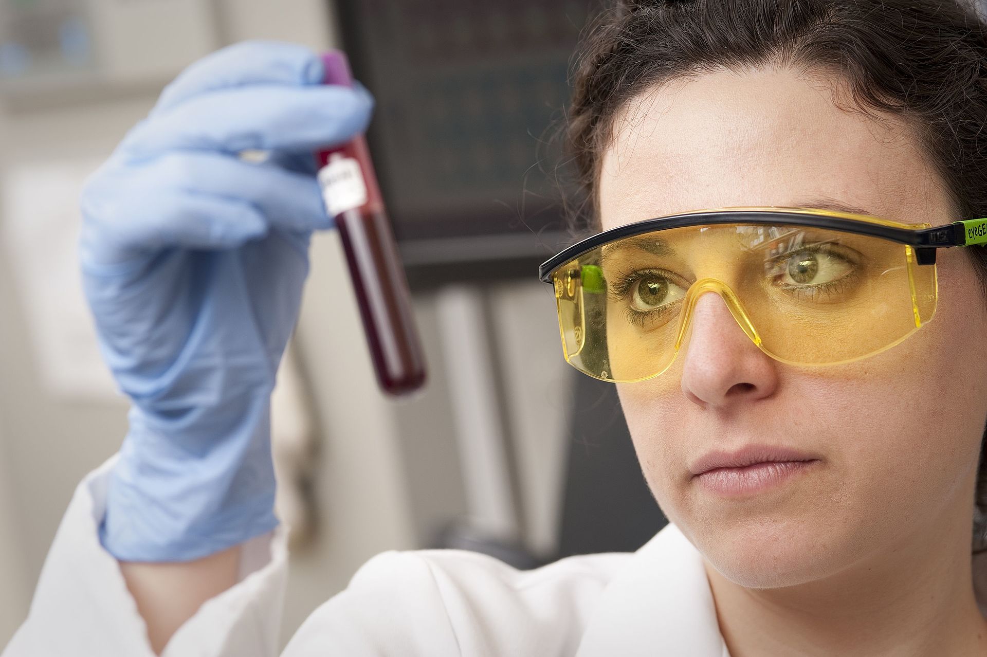 Blood samples being checked in a laboratory, part of what a full body health scan includes