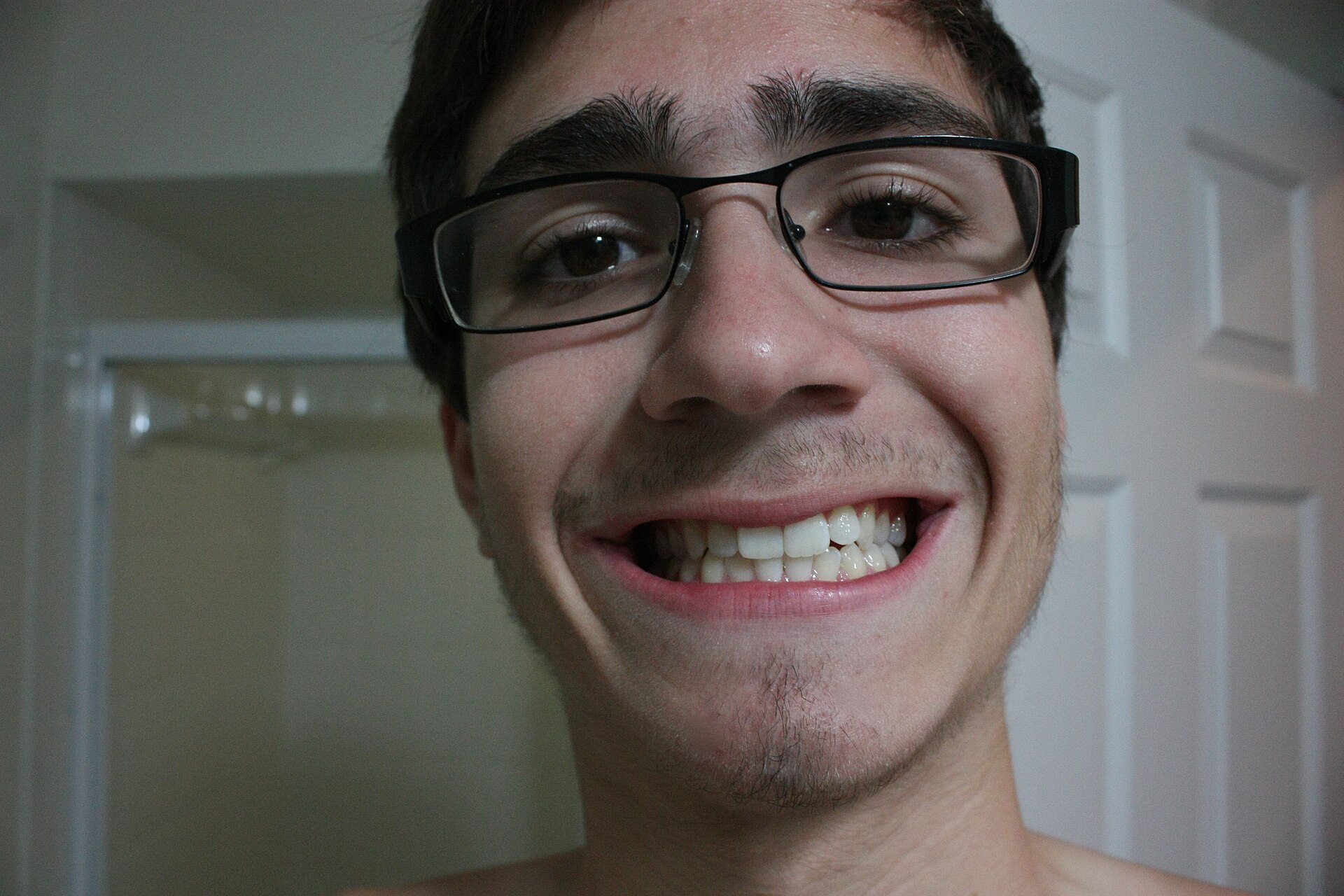 A man showing the result of a whitening treatment, the outcome teeth whitening kits sold in the UK cannot legally deliver