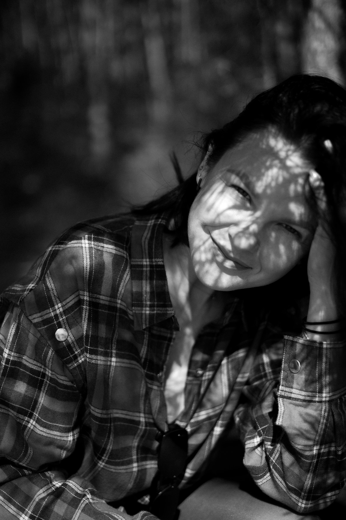 Dappled sunlight falling across a woman's face - UV and visible light are the main triggers for melasma