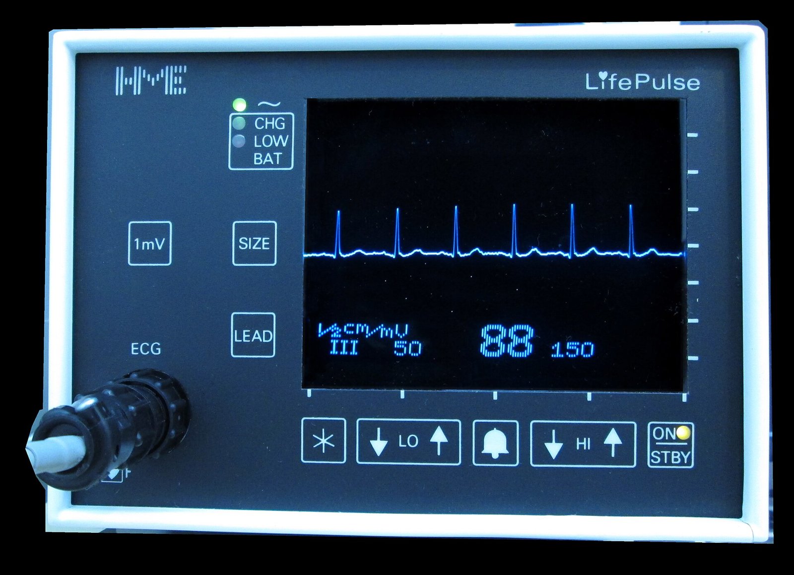 ECG heart monitor showing a normal rhythm trace